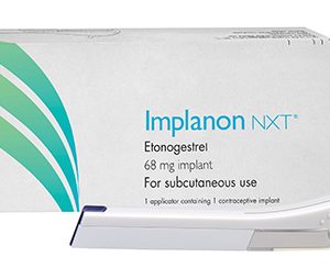 Implanon 68mg NXT etonogestrel Subcutaneo